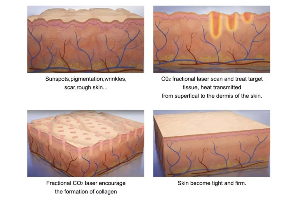 Laser Skin Body Treatments e1789143873159 1024x683