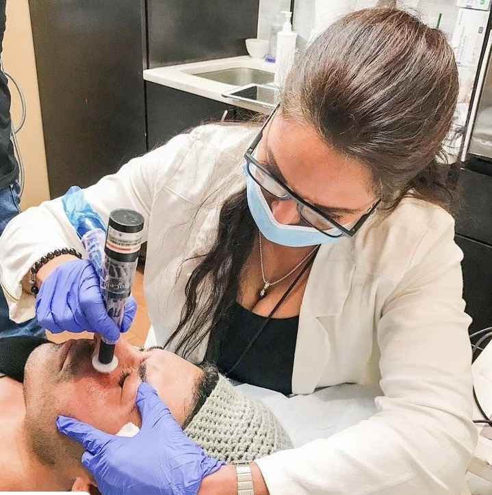 Microneedling with and without RF